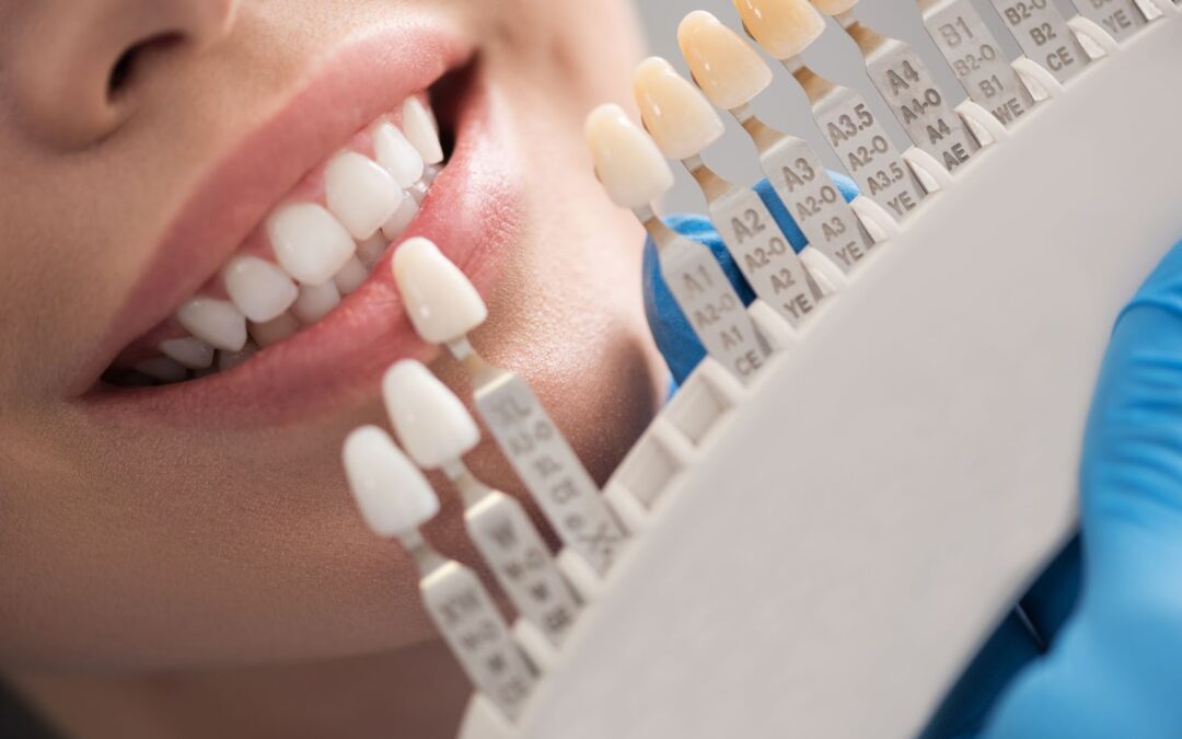 10 Common Dental Crown Problems and Their Solutions