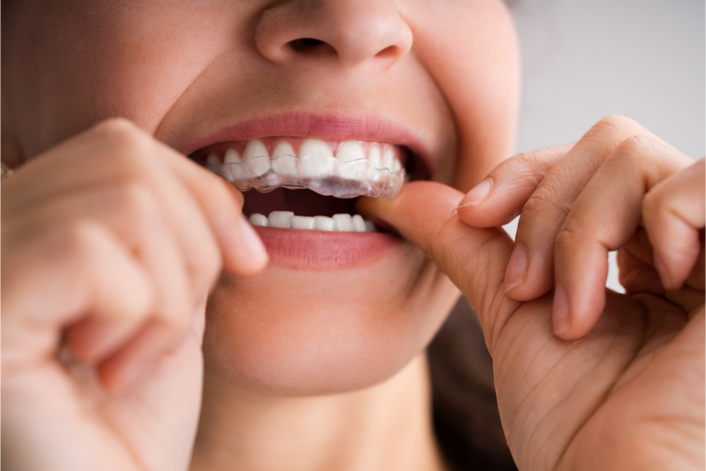 A woman wearing a night guard to protect their teeth from grinding