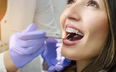 Orthodontics for Adults with Dr Anastasia Bakopoulou