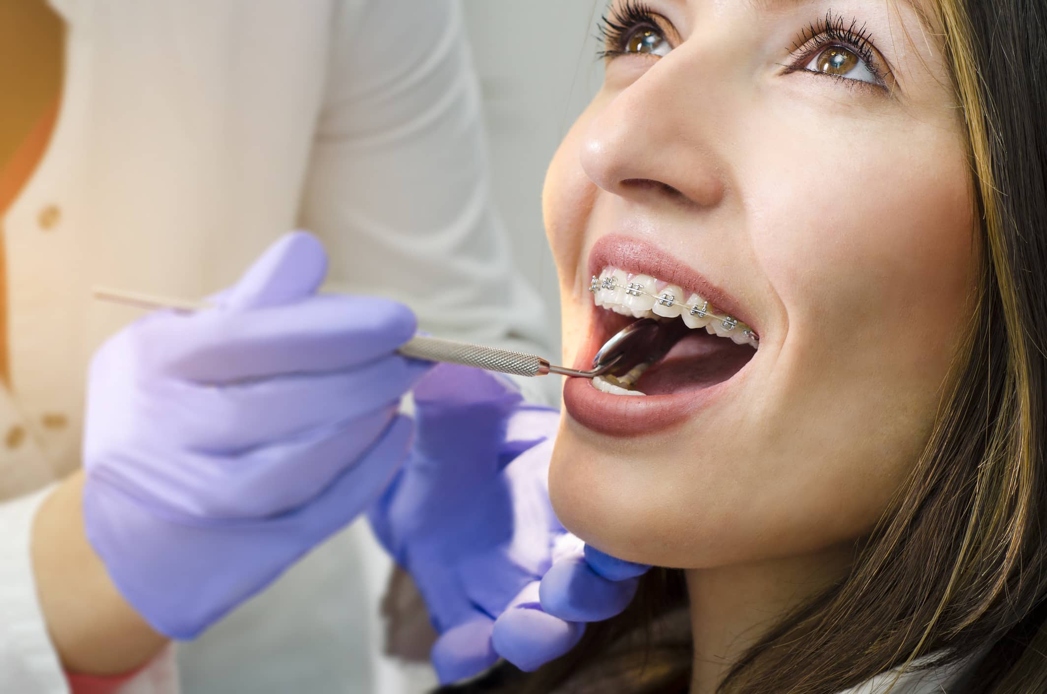 Close-up of smiling woman with ceramic braces during orthodontic check-up at Beaches Dental Mona Vale