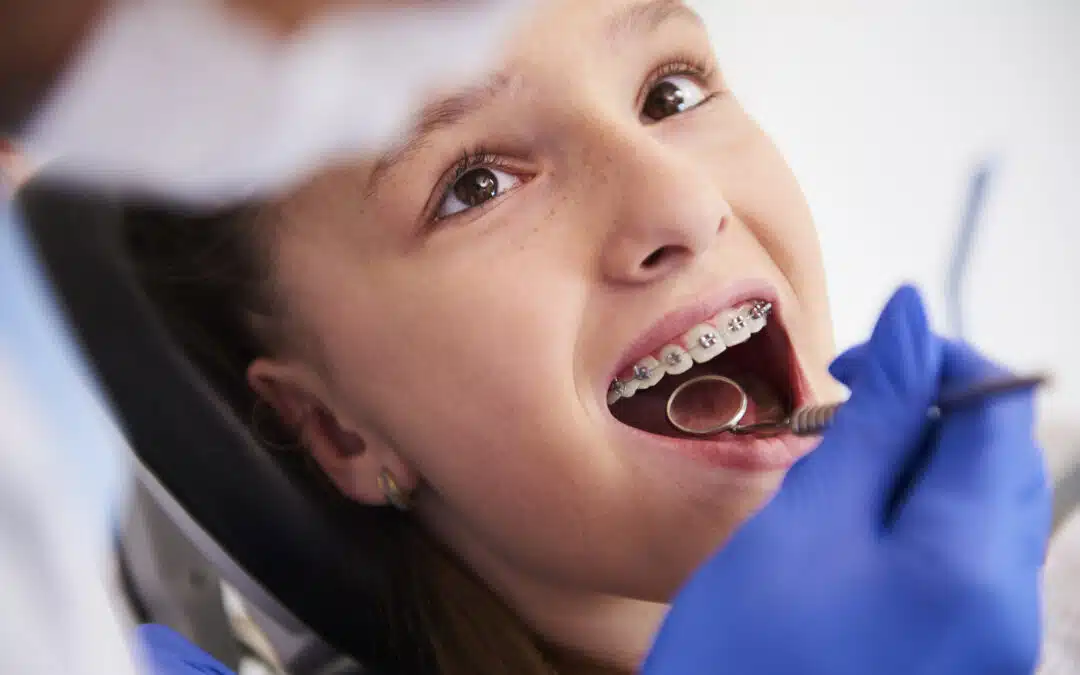 Braces for Children in Mona Vale: A Parent’s Guide