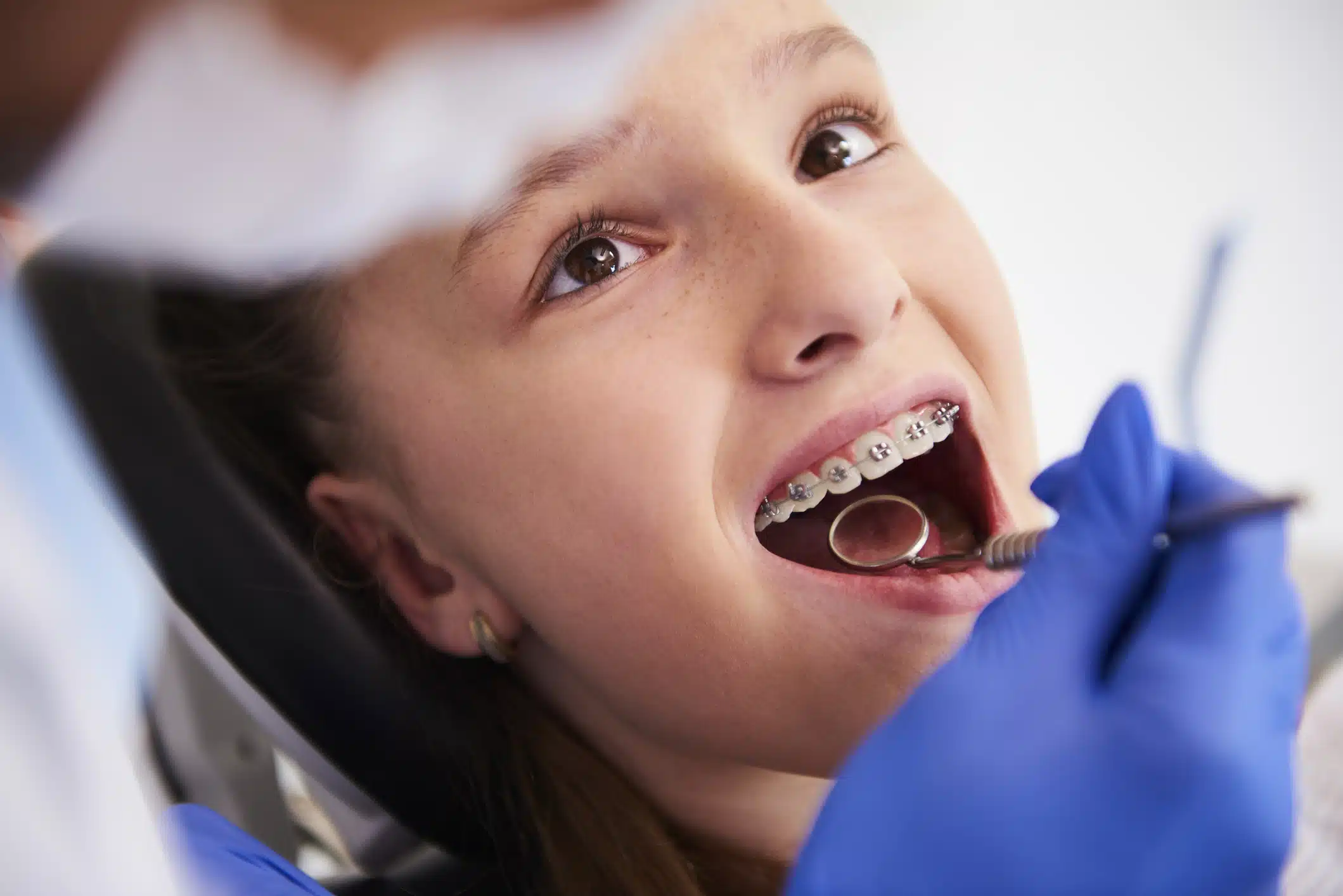 Child with metal braces smiling during orthodontic check-up at Mona Vale dental practice