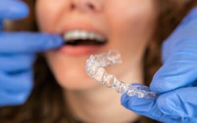 How Does Invisalign Work? Your Guide To A Straighter Smile