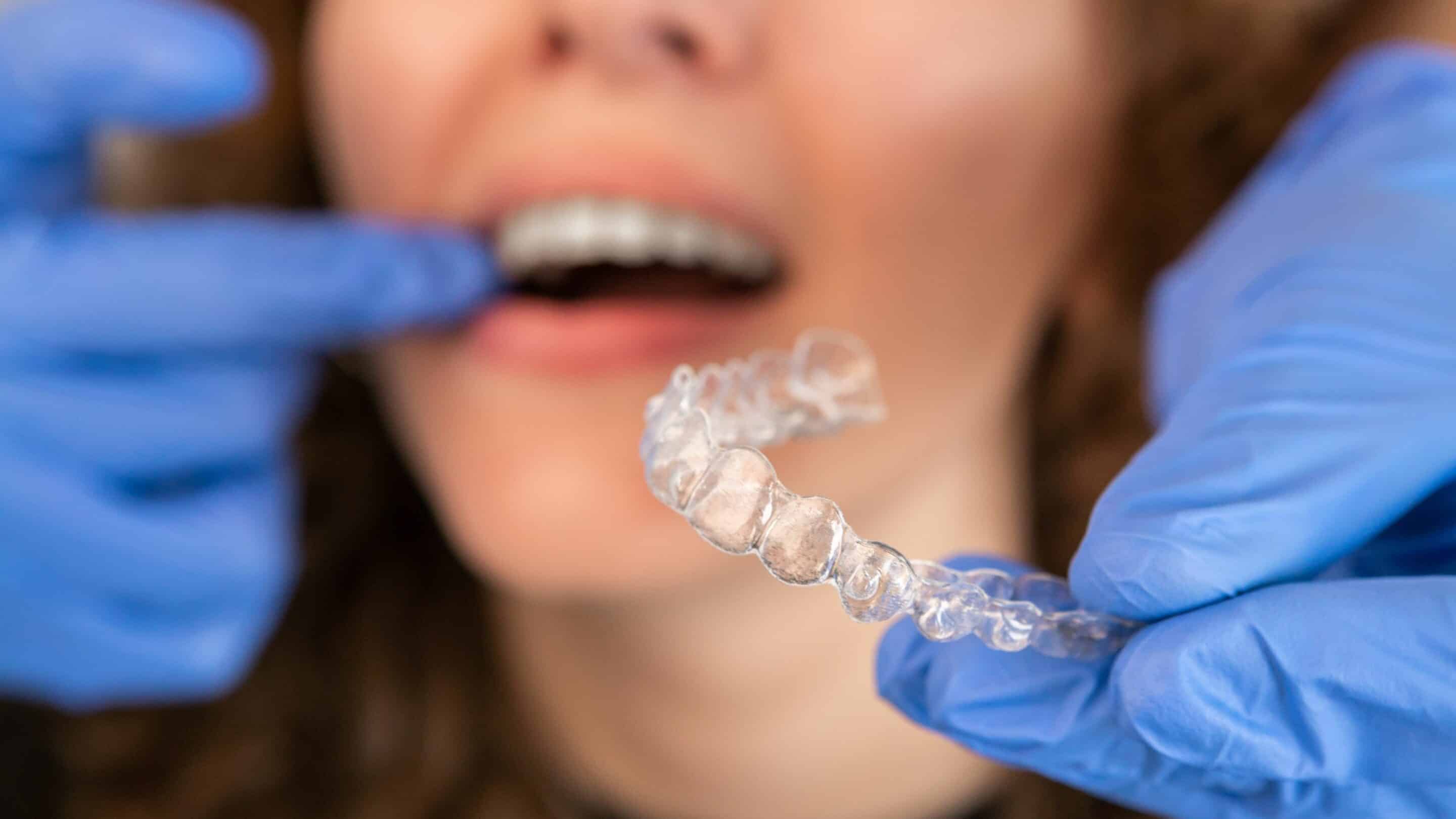 Dentist holding Invisalign aligner near patient's mouth