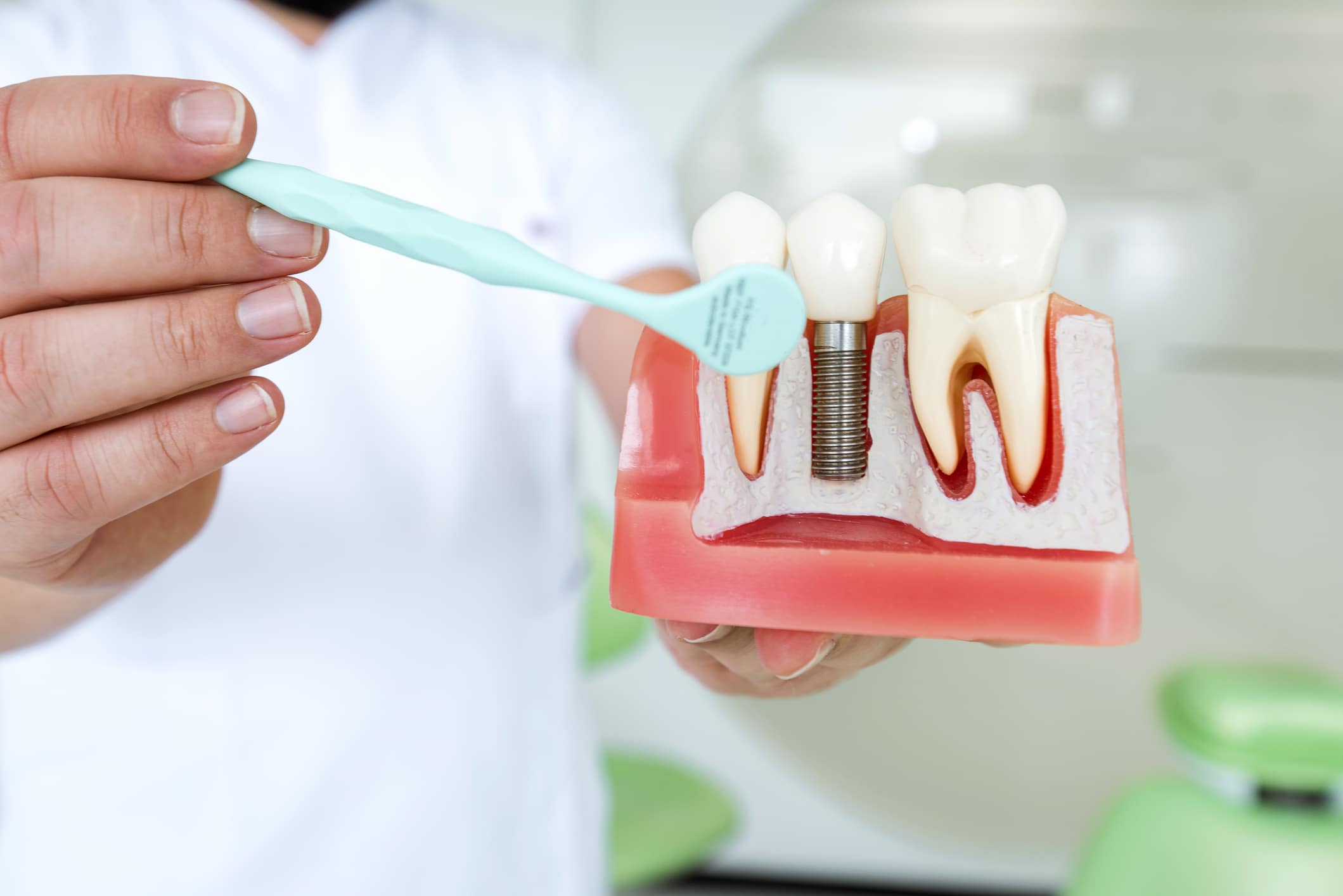 Male dentist explaining dental implants to a patient.