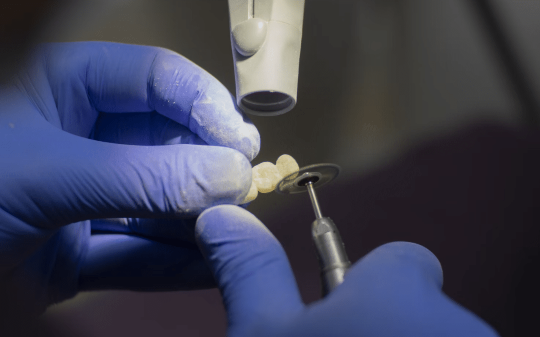 What Can I Do for Missing Teeth?
