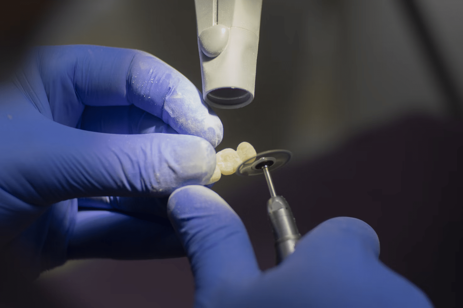 What Can I Do for Missing Teeth