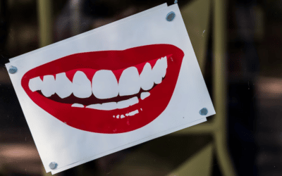 What to Eat and Not to Eat After Teeth Whitening in Mona Vale