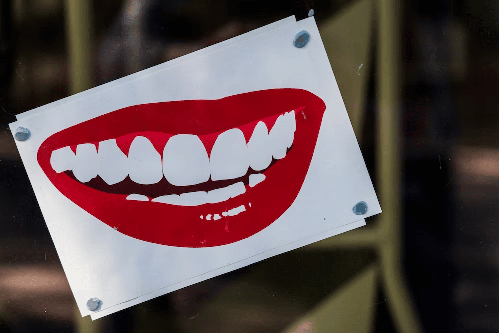 What to Eat and Not to Eat After Teeth Whitening in Mona Vale