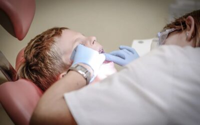 When Do You Need Composite Dental Fillings?