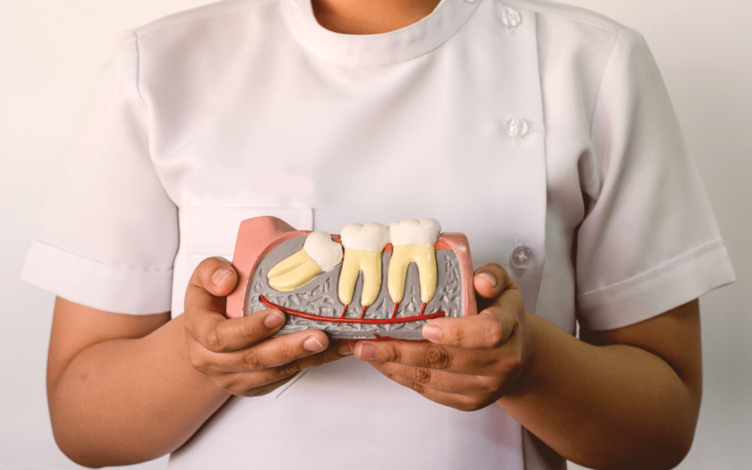 Wisdom Teeth Explained | Northern Beaches Wisdom Teeth Removal