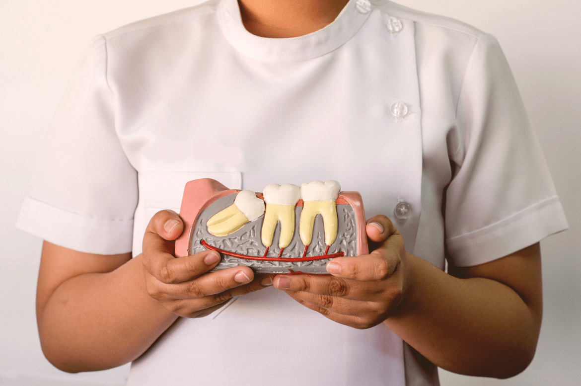 a woman holding a cross section model of a wisdom tooth