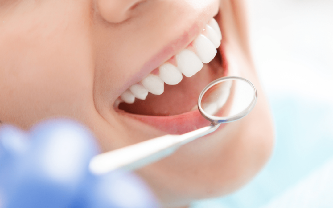 Fillings: What’s Involved and Why You May Need One