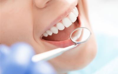 Fillings: What’s Involved and Why You May Need One