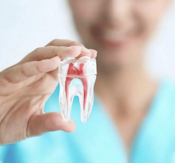 Root Canal Treatment Part 2: What Does a Root Canal Procedure Looks Like